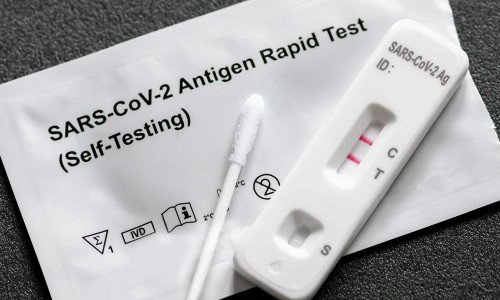 Covid-19 Antigen Rapid Test Kit